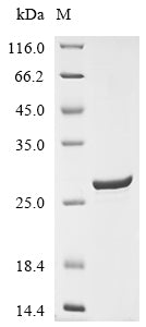 (Tris-Glycine gel) Discontinuous SDS-PAGE (reduced) with 5% enrichment gel and 15% separation gel.
