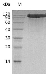 SDS-PAGE