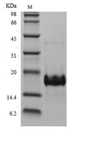 SDS-PAGE