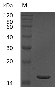 SDS-PAGE
