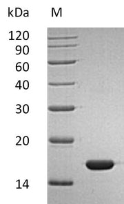 SDS-PAGE