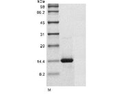 SDS-PAGE