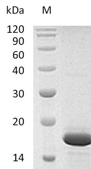 SDS-PAGE