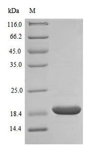 SDS-PAGE