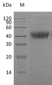 SDS-PAGE