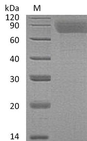 SDS-PAGE