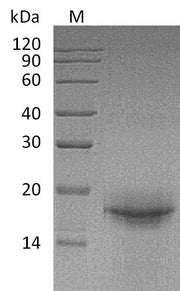 SDS-PAGE