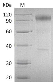 SDS-PAGE