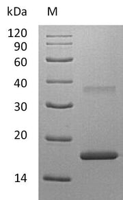 SDS-PAGE