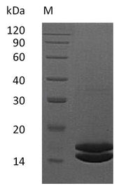 SDS-PAGE