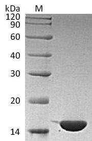 SDS-PAGE