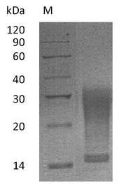 SDS-PAGE