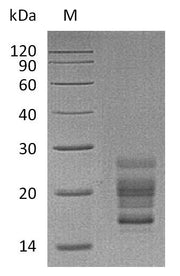 SDS-PAGE