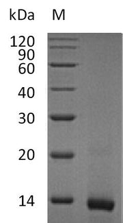 SDS-PAGE