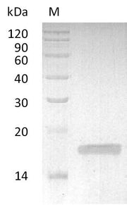 SDS-PAGE
