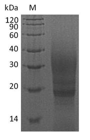 SDS-PAGE