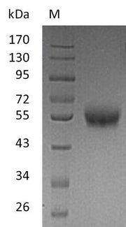 SDS-PAGE