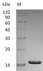 SDS-PAGE