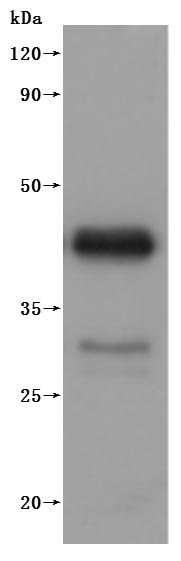 Western Blot
