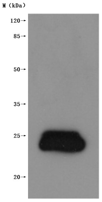 Western Blot