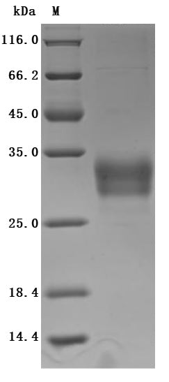 SDS-PAGE