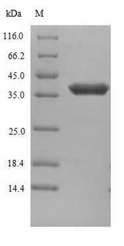SDS-PAGE