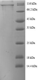 SDS-PAGE
