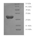 SDS-PAGE