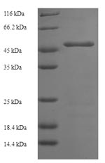 SDS-PAGE