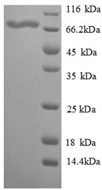 SDS-PAGE