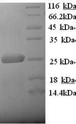 SDS-PAGE