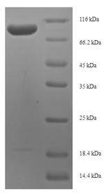 SDS-PAGE