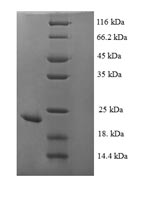 SDS-PAGE