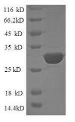SDS-PAGE