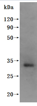 Western Blot