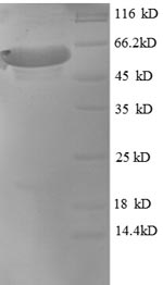 SDS-PAGE