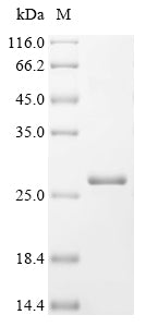 SDS-PAGE