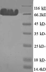 SDS-PAGE