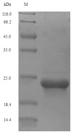 SDS-PAGE