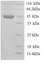 SDS-PAGE