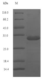 SDS-PAGE
