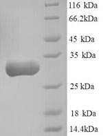 SDS-PAGE