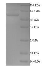 SDS-PAGE