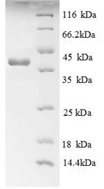 SDS-PAGE