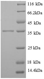 SDS-PAGE