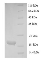 SDS-PAGE