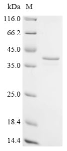 SDS-PAGE