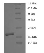 SDS-PAGE