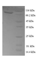 SDS-PAGE