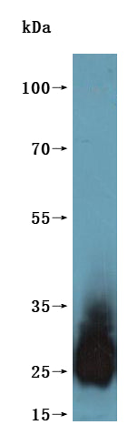 Western Blot